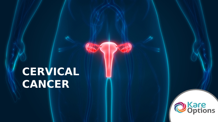 Cervical Cancer-KareOptions