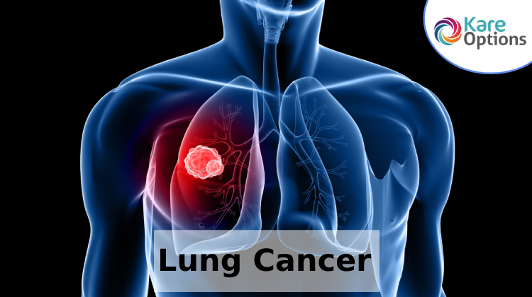 lung-cancer